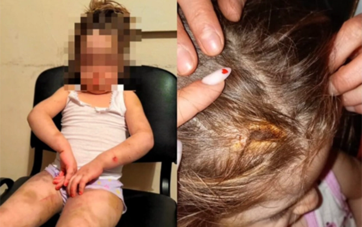 byl0kcfcspvCcPSgyKi3dAuFn3b5dfElbYW3udDe_1200