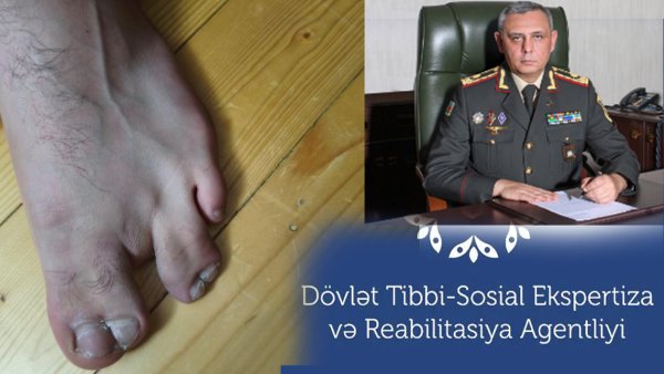 1777278860_3-barmaqli-esger